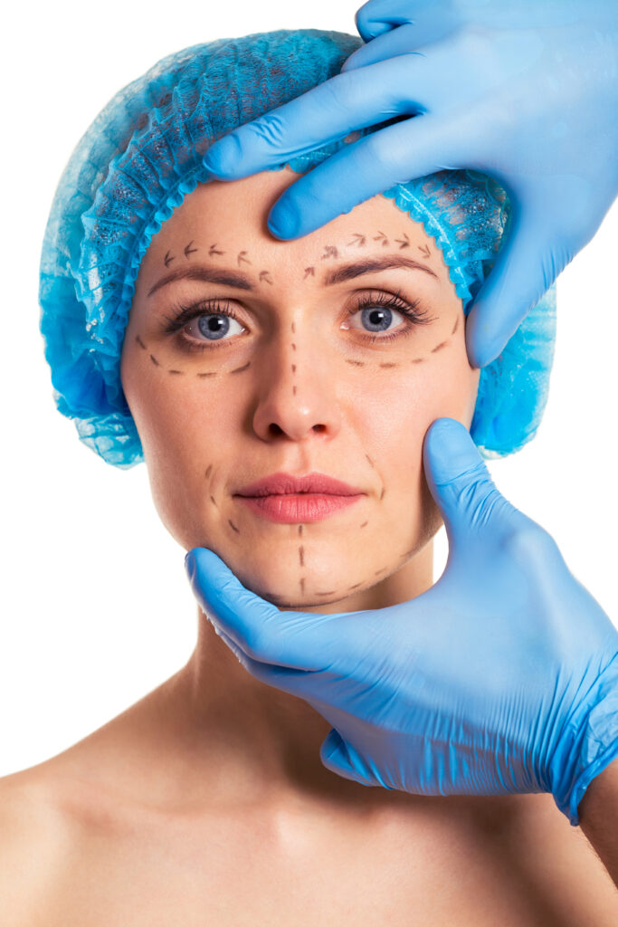 Volto di una donna con cuffietta chirurgica e il disegno del lifting sul volto.